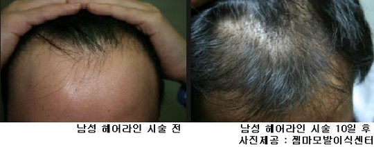 라인헤어 이미지