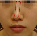 쟤 코 왜 저래? 수술 잘못한 거 아니야?
