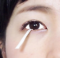눈물은 말라도 병, 넘쳐도 병?