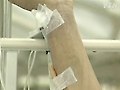 제천에서 신종플루 확진 환자 사망