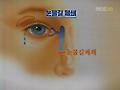 눈물 지나치면 병