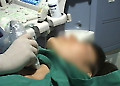 [건강] 갑상선에 생긴 혹, 고주파로 치료하세요