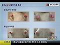 치료용 '유산균 폭탄' 개발